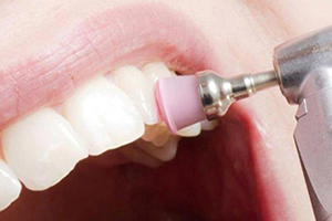 بروساژ دندان چیست؟