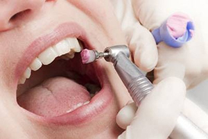 بروساژ دندان چیست؟