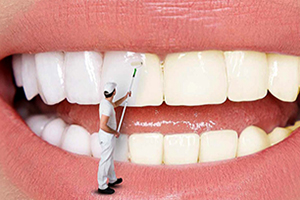 منظور از بلیچینگ دندان چیست؟