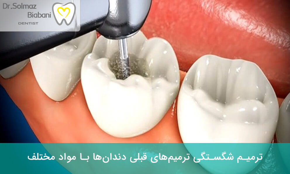شکستن ترمیم شدگی دندان