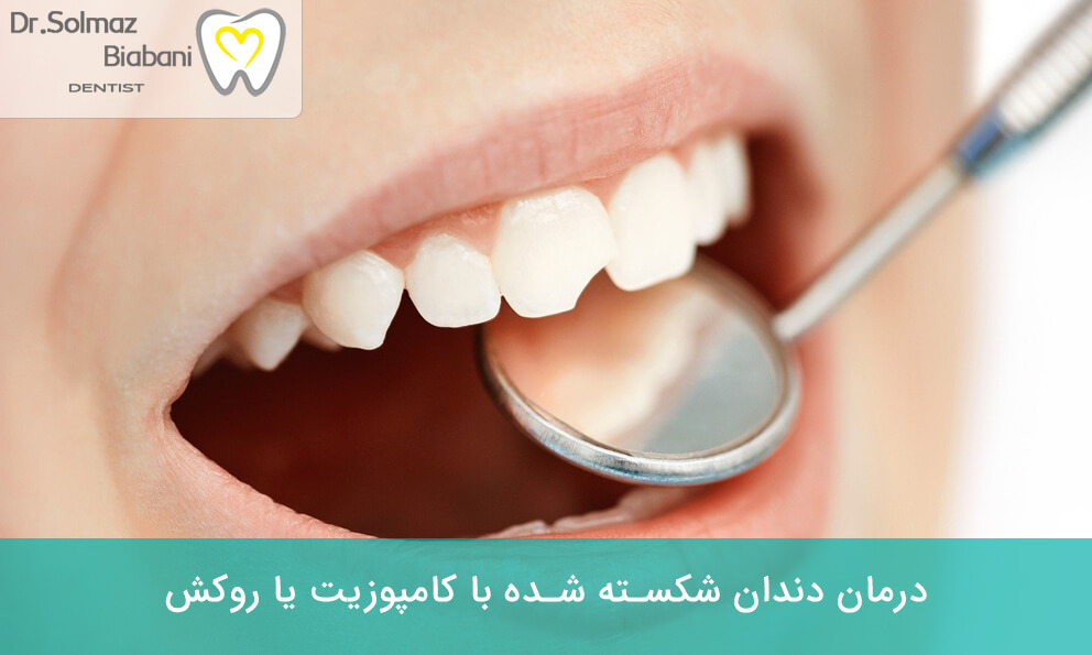 روش‌های ترمیم دندان لب پَر شده
