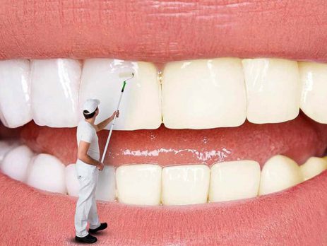 عوارض بلیچینگ دندان