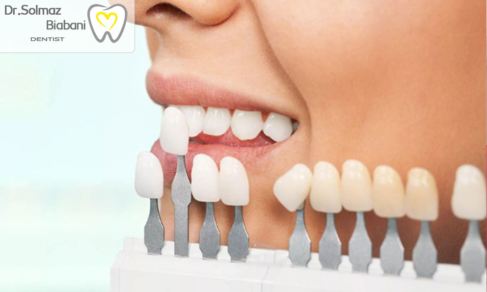 بررسی نتایج کار دندانپزشک