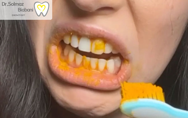 عوارض زردچوبه برای سفید کردن دندان